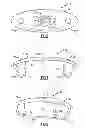 Fig. 04 - Sports training system