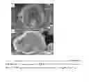 Fig. 04 - MICELLE-COATED CRYSTALLINE PARTICLES
