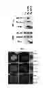 Fig. 04 - Use of leucyl tRNA synthetase