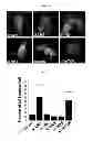Fig. 09 - Use of leucyl tRNA synthetase