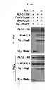Fig. 15 - Use of leucyl tRNA synthetase