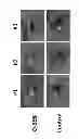 Fig. 05 - Compositions for Controlling Vascularization in Ophthalmological and Dermatological Diseases