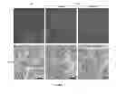 Fig. 09 - Systemic gene replacement therapy for treatment of X-linked myotubular myopathy (XLMTM)
