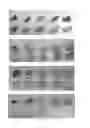 Fig. 06 - Continuous administration of L-dopa, dopa decarboxylase inhibitors, catechol-O-methyl transferase inhibitors and compositions for same