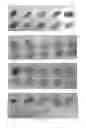 Fig. 06 - Continuous administration of L-dopa, dopa decarboxylase inhibitors, catechol-O-methyl transferase inhibitors and compositions for same