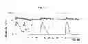 Fig. 09 - Continuous administration of dopa decarboxylase inhibitors and compositions for same