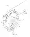 Fig. 02 - Method and apparatus for emission guided radiation therapy