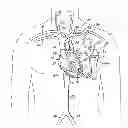 Fig. 01 - Devices, methods and systems for establishing supplemental blood flow in the circulatory system