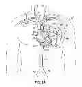 Fig. 02 - Devices, methods and systems for establishing supplemental blood flow in the circulatory system