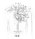 Fig. 03 - Devices, methods and systems for establishing supplemental blood flow in the circulatory system