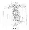 Fig. 04 - Devices, methods and systems for establishing supplemental blood flow in the circulatory system