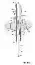 Fig. 10 - Devices, methods and systems for establishing supplemental blood flow in the circulatory system