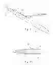Fig. 02 - Implantable penile prosthesis