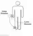 Fig. 01 - Estimation of the dry weight of a dialysis patient