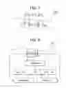 Fig. 06 - Estimation of the dry weight of a dialysis patient