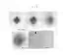 Fig. 24 - Self-assembled, micropatterned, and radio frequency (RF) shielded biocontainers and their uses for remote spatially controlled chemical delivery