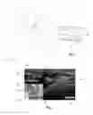 Fig. 02 - IMAGE SYSTEM FOR PERCUTANEOUS INSTRUMENT GUIDENCE