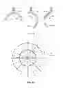 Fig. 22 - COMPENSATOR-BASED BRACHYTHERAPY
