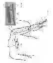 Fig. 07 - BODY-WORN SYSTEM FOR CONTINUOUS, NONINVASIVE MEASUREMENT OF CARDIAC OUTPUT, STROKE VOLUME, CARDIAC POWER, AND BLOOD PRESSURE