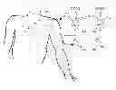 Fig. 01 - Body-worn system for continuous, noninvasive measurement of cardiac output, stroke volume, cardiac power, and blood pressure