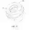Fig. 15 - Insertable endoscopic instrument for tissue removal