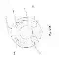 Fig. 53 - Insertable endoscopic instrument for tissue removal