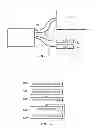Fig. 04 - Method and system for thermal and compression therapy relative to the prevention of deep vein thrombosis