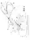Fig. 02 - Ocular implant system and method