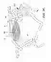 Fig. 04 - Ocular implant system and method