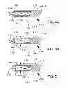Fig. 06 - Ocular implant system and method