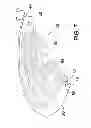 Fig. 08 - Ocular implant system and method