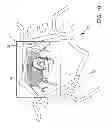 Fig. 11 - Ocular implant system and method