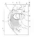 Fig. 13 - Ocular implant system and method