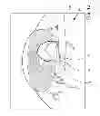 Fig. 14 - Ocular implant system and method