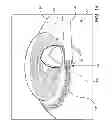 Fig. 15 - Ocular implant system and method