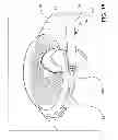 Fig. 16 - Ocular implant system and method