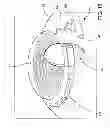 Fig. 17 - Ocular implant system and method