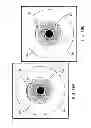 Fig. 20 - Ocular implant system and method