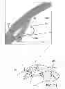 Fig. 23 - Ocular implant system and method