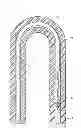 Fig. 01 - Devices and methods for clearing occlusions and for providing irrigation in in-situ artificial and natural lumens