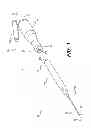 Fig. 02 - Medical devices having releasable coupling