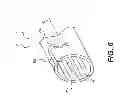 Fig. 08 - Medical devices having releasable coupling