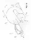 Fig. 10 - Medical devices having releasable coupling