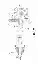 Fig. 11 - Medical devices having releasable coupling