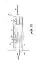 Fig. 13 - Medical devices having releasable coupling