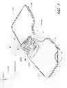 Fig. 02 - Catheter securement device
