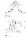 Fig. 09 - Catheter securement device