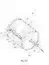 Fig. 05 - Needle safety device