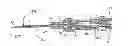 Fig. 03 - Catheter device with needle guard