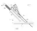 Fig. 05 - Vascular access systems and methods of use